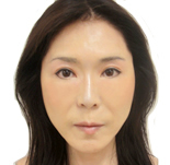 美顔形成 吸引&脂肪・幹細胞注入