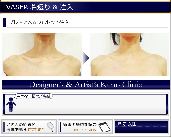 若返り&注入 プレミアム☆フルセット注入