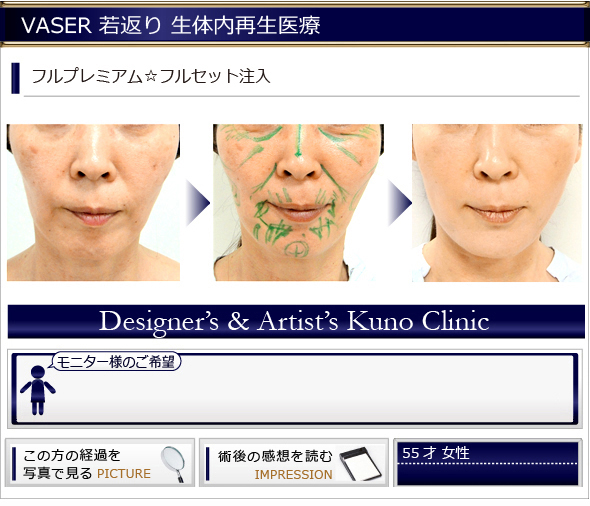 若返り 生体内再生医療