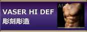 VASER HI DEF 