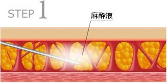 STEP1 t牺bwɒ