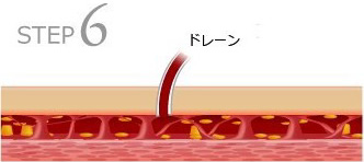 STEP6 dオXɗǂ鏈u