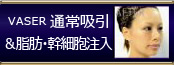 VASER 通常吸引&脂肪・幹細胞注入
