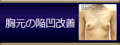 オリジナル施術 胸元の陥凹改善