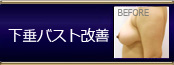 オリジナル施術 下垂バスト改善