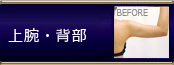 他院修正 上腕・背部