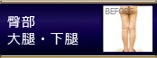 他院修正 臀部・大腿・下腿