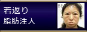 若返り脂肪注入