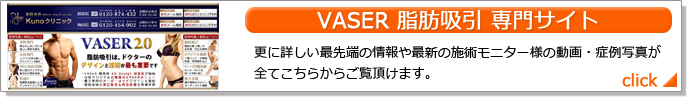 VASER bz TCg XɏڂŐ[̃xCU[gp̏ŐV̎{pj^[l̓EǗʐ^SĂ炩炲܂B