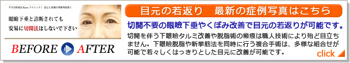 目元の若返り　最新の症例写真はこちら。切開不要の眼瞼下垂治療やくぼみ改善で目元の若返りが可能です。