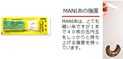 NANI糸の強度