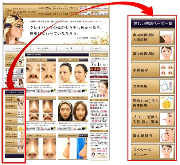 鼻の整形サイト